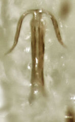 Anzygina agni