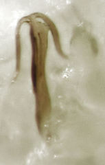 Anzygina agni