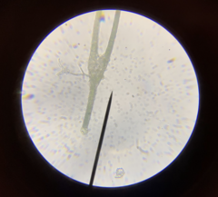 Fissidens ventricosus