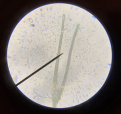 Fissidens ventricosus