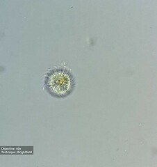 Rimostrombidium
