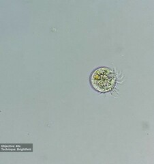 Rimostrombidium