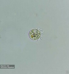 Rimostrombidium