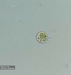 Rimostrombidium