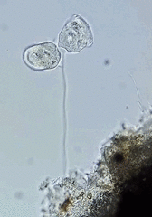 Vorticellidae