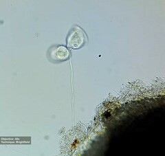 Vorticellidae
