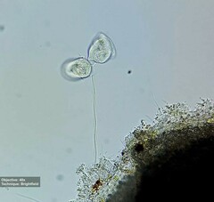 Vorticellidae