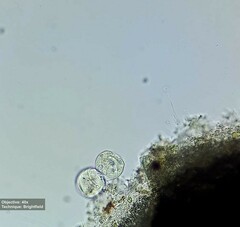 Vorticellidae