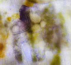 Stentor amethystinus