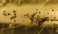 Stentor amethystinus