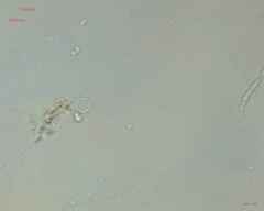 Coscinodiscophycidae