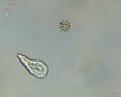 Heliozoa