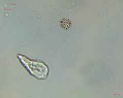 Heliozoa