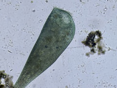 Stentor coeruleus