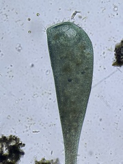 Stentor coeruleus