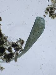 Stentor coeruleus