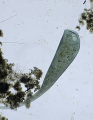 Stentor coeruleus