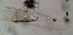 Eutintinnus