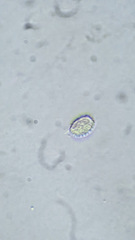 Melanoleuca polioleuca