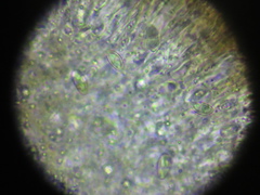 Nesolechia oxyspora oxyspora