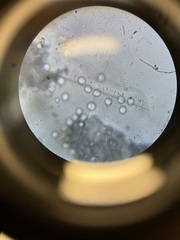 Ceratiomyxa fruticulosa