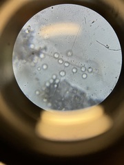 Ceratiomyxa fruticulosa