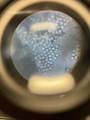 Ceratiomyxa fruticulosa