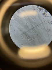 Ceratiomyxa fruticulosa