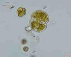 Cosmarium