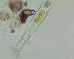 Charophyta