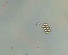 Scenedesmaceae