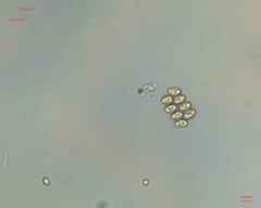 Scenedesmaceae