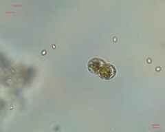 Cosmarium