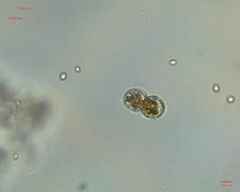 Cosmarium
