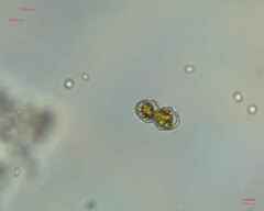 Cosmarium