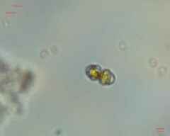 Cosmarium
