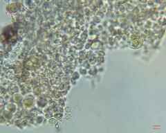Microcystis