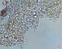 Microcystis