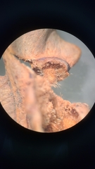 Callirhytis quercusfutilis