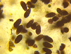 Hysterobrevium mori