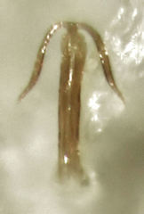 Anzygina agni