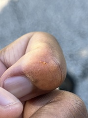 Pseudomyrmex simplex