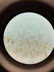 Laccaria laccata pallidifolia
