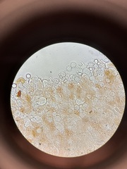 Laccaria laccata pallidifolia