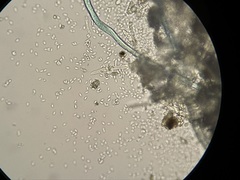 Botryosporium