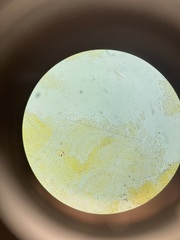 Orbilia xanthostigma