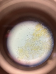 Orbilia xanthostigma