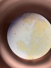 Orbilia xanthostigma