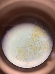 Orbilia xanthostigma