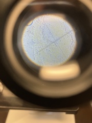 Orbilia xanthostigma